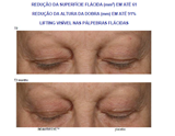 Creme Cirúrgico Tri-Up 30g
