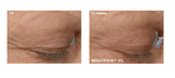 Creme Cirúrgico Tri-Up 30g