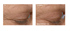 Creme Cirúrgico Tri-Up 30g