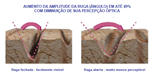 Creme Cirúrgico Tri-Up 30g